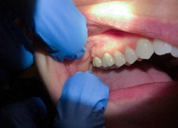 Best Pediatric Emergency Dentist in South Deerfield, MA
